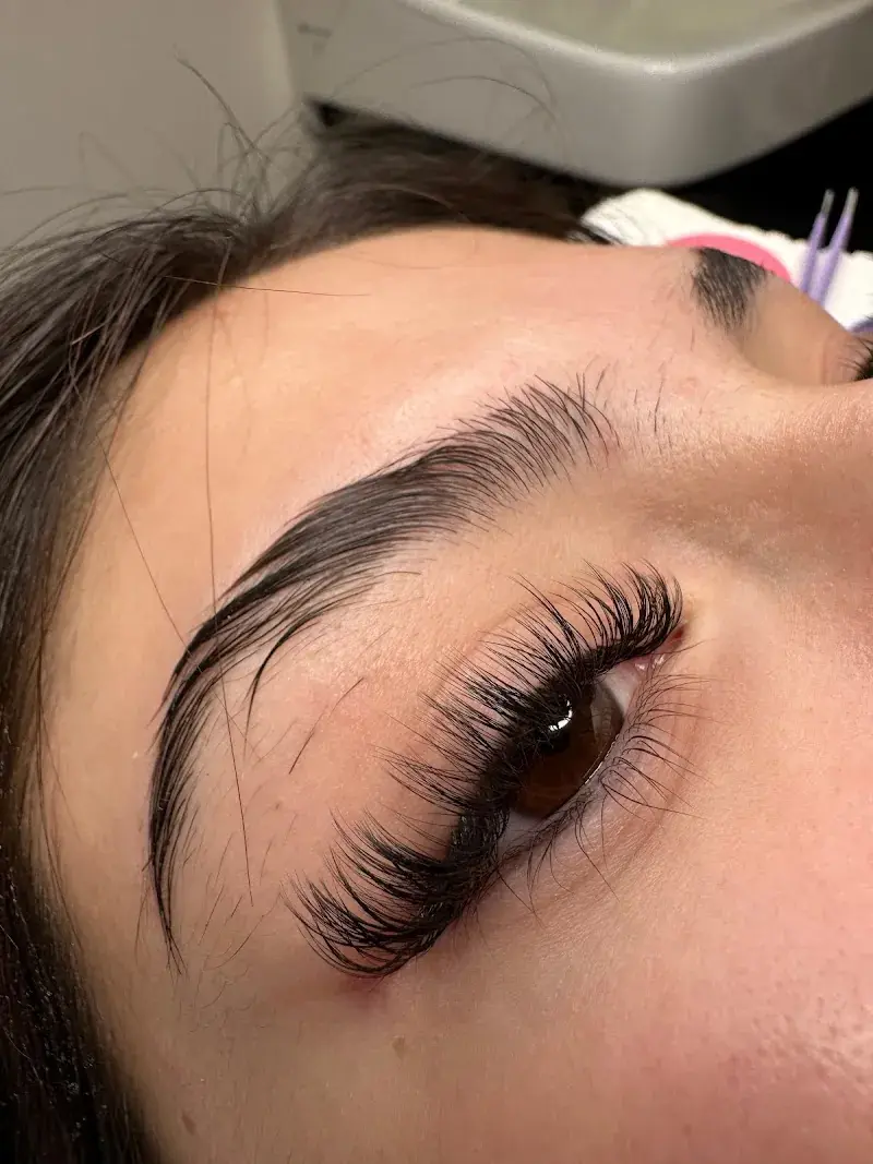 Renew Med Spa in Albuquerque, NM