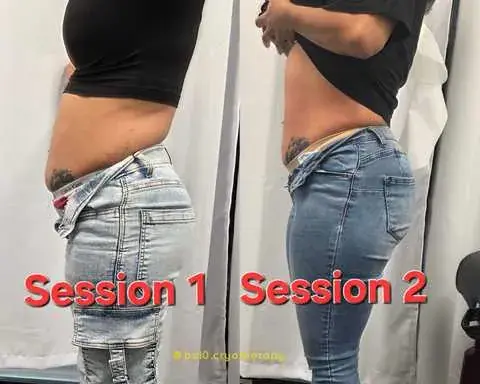 Bel0 Cryotherapy LLC in East Hanover, NJ