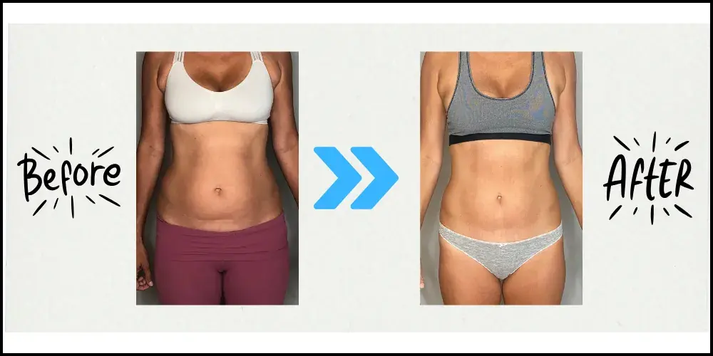 Below Zero Cryo & Beauty in Morgantown, WV