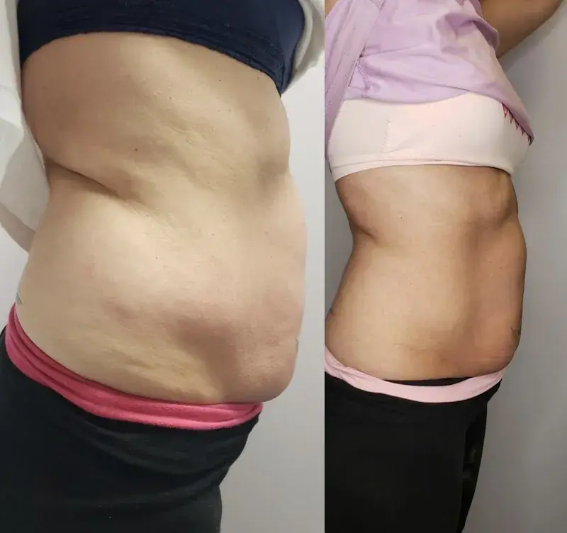 Cryo You (Gillette) in Gillette, WY