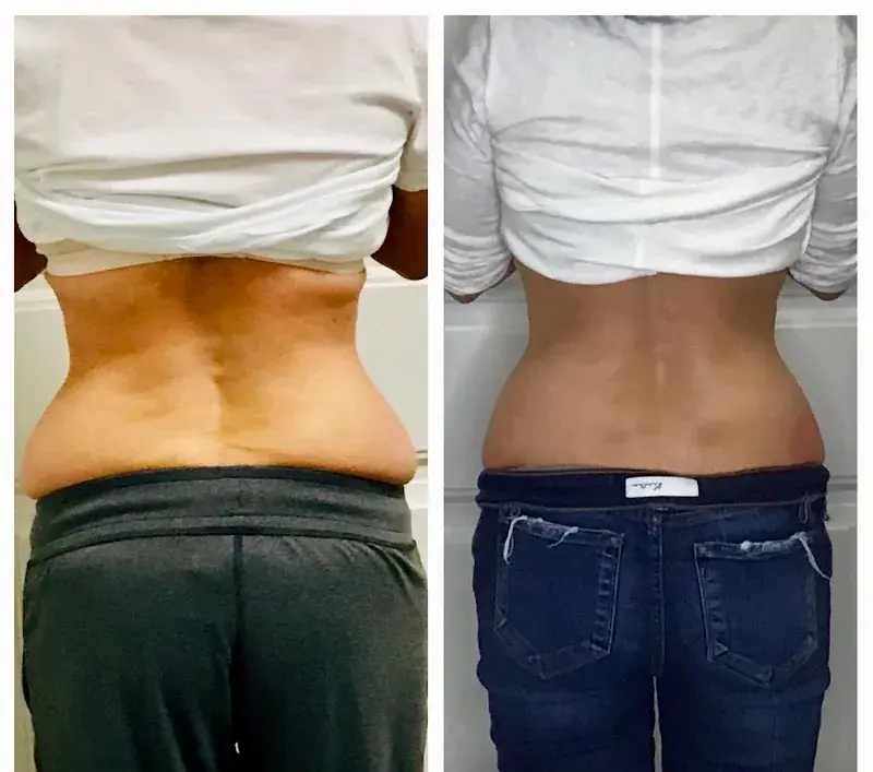 Cryo You (Spearfish) in Spearfish, SD