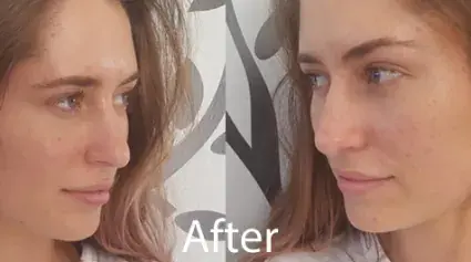 Glacial Peak Cryotherapy in West Fargo, ND