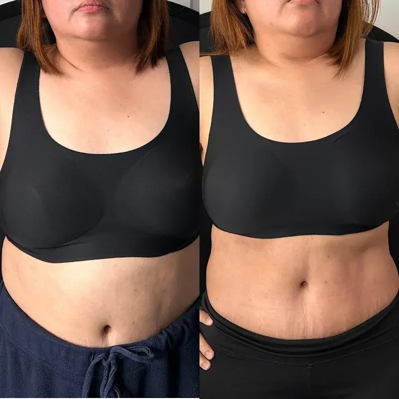 MyCryoHealth in Olympia, WA