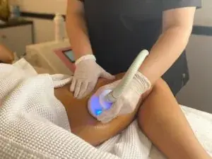 THRIVE CRYOSTUDIO in Annapolis, MD